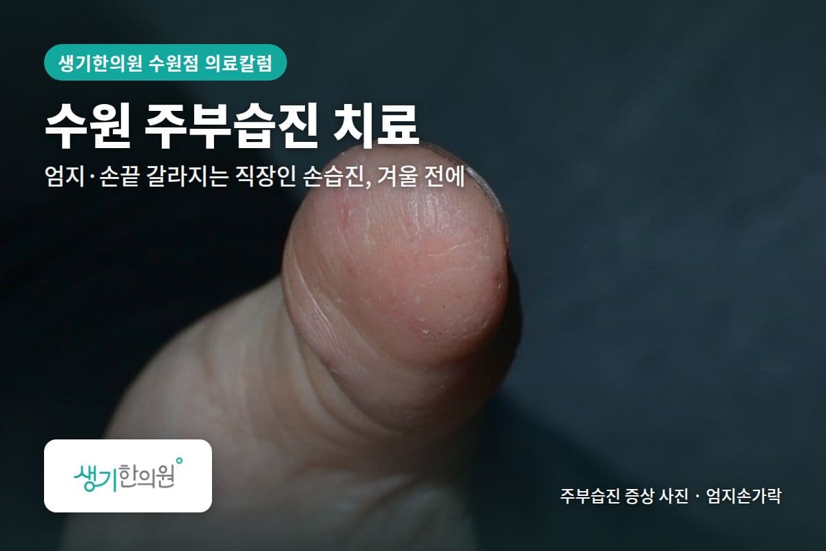 엄지손가락 주부습진 증상 사진과 문구 「수원 주부습진 치료, 엄지·손끝 갈라지는 직장인 손습진, 겨울 전에 · 생기한의원 수원점」