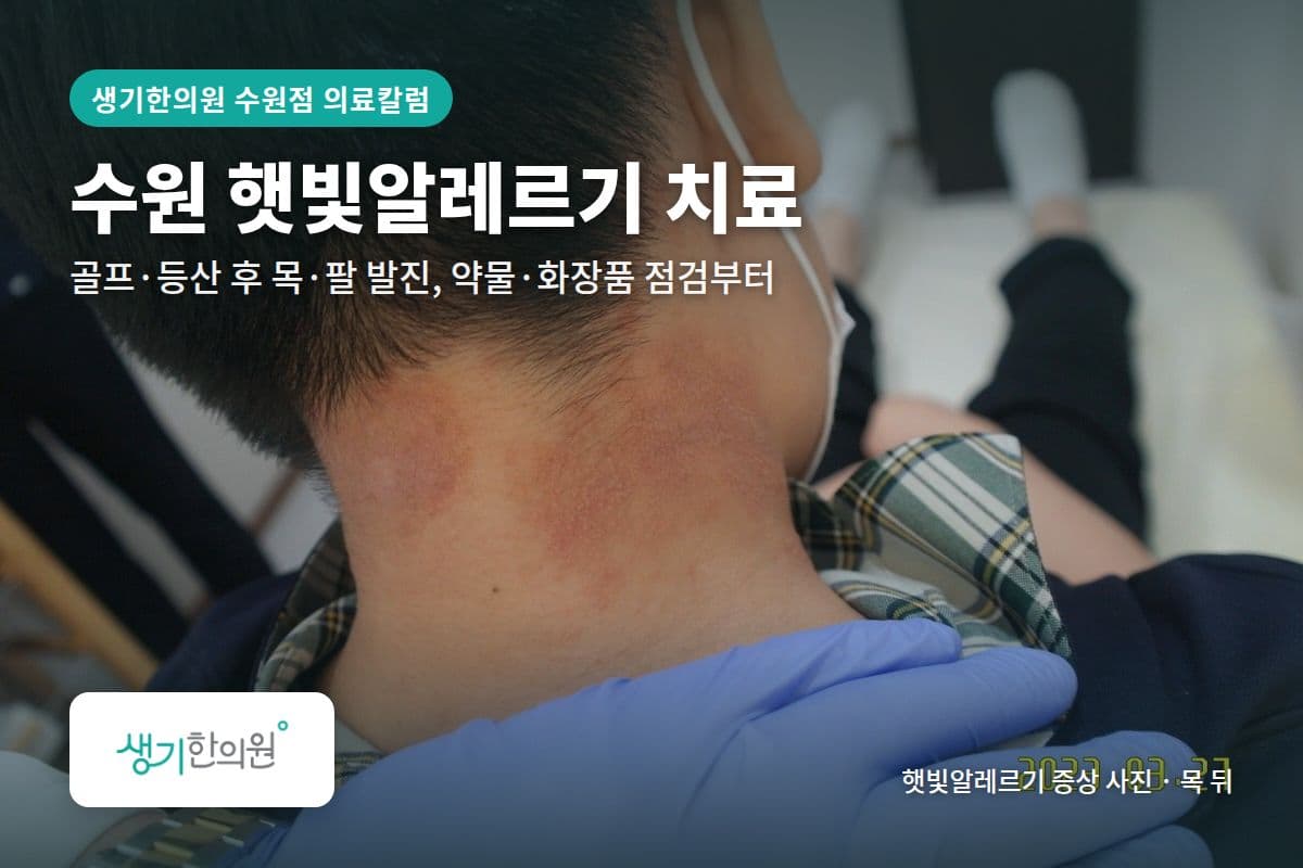 목 뒤 햇빛알레르기 증상 사진과 문구 「수원 햇빛알레르기 치료, 골프·등산 후 목·팔 발진, 약물·화장품 점검부터 · 생기한의원 수원점」